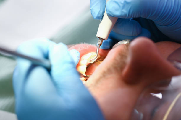 Best Emergency Denture Repair in Poulsbo, WA