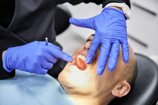 Best Emergency Wisdom Teeth Removal in Poulsbo, WA