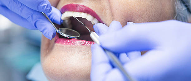 Best Emergency Treatment for Dental Infections or Abscesses in Poulsbo, WA